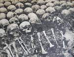 Schädel mit verbundenen Augen, Tuol Sleng, Phnom Penh, Kambodscha.